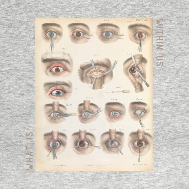 What is Within Us Vintage Tee Collection// Eye Surgery by ArtHaven